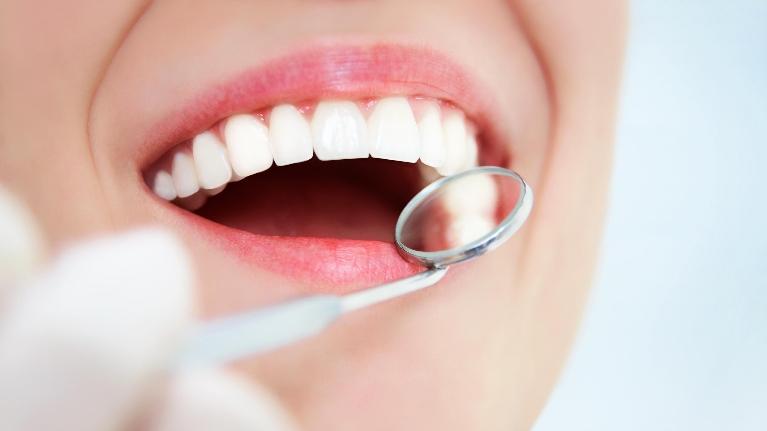 White Teeth Smiling | Phinney Ridge Dental