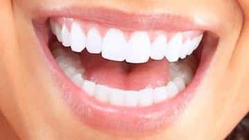 Close up of smile | teeth whitening seattle