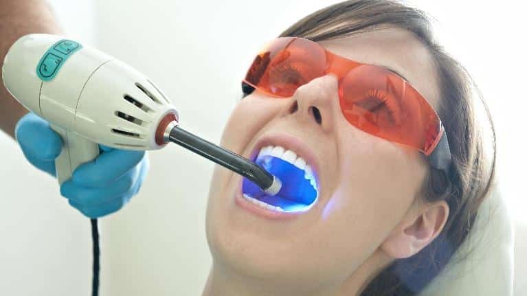 Teeth Whitening Procedure | Phinney Ridge Dental